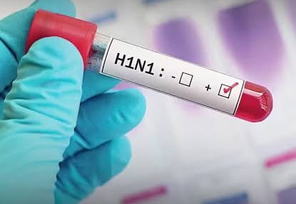Jharkhand Sounds Alert After Eight Test Positive for H1N1